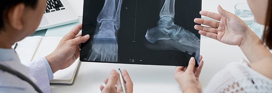 foot-x-ray