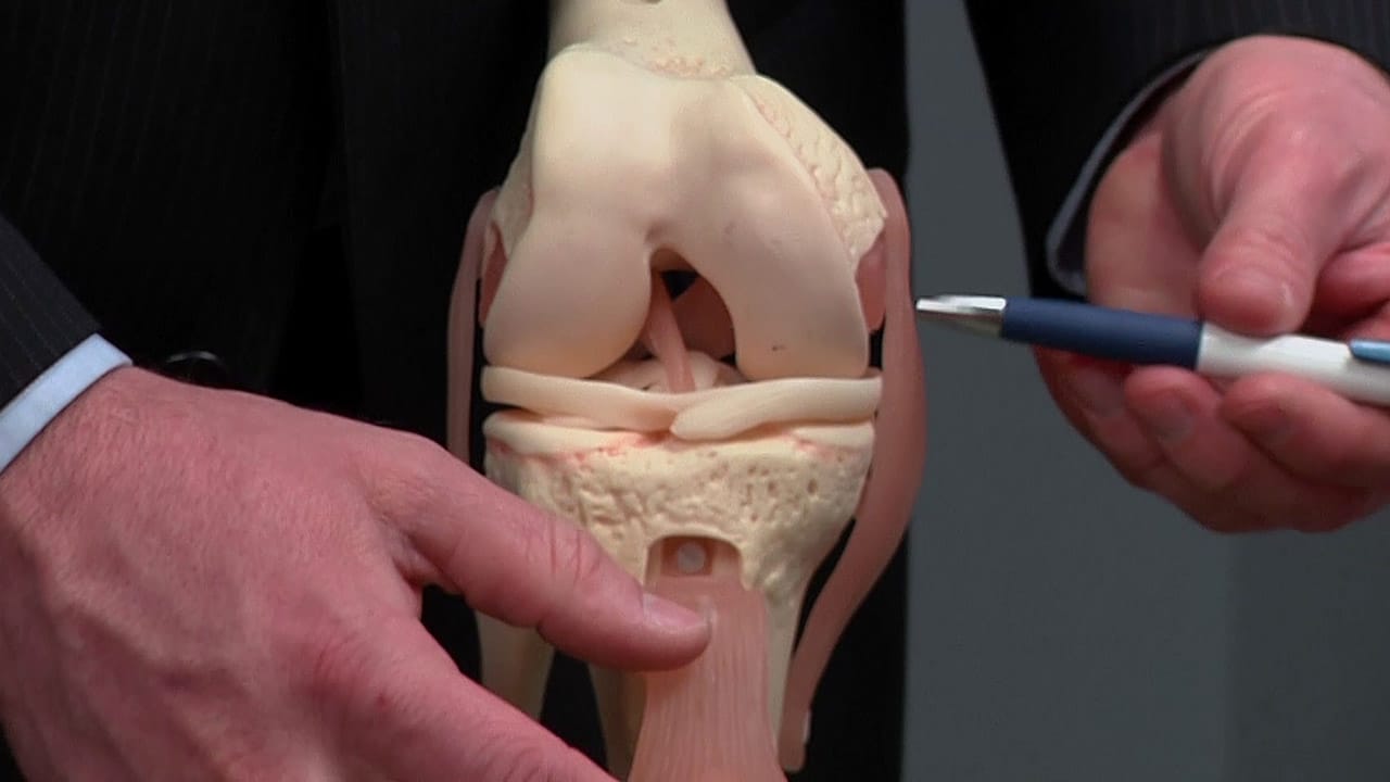 Knee model