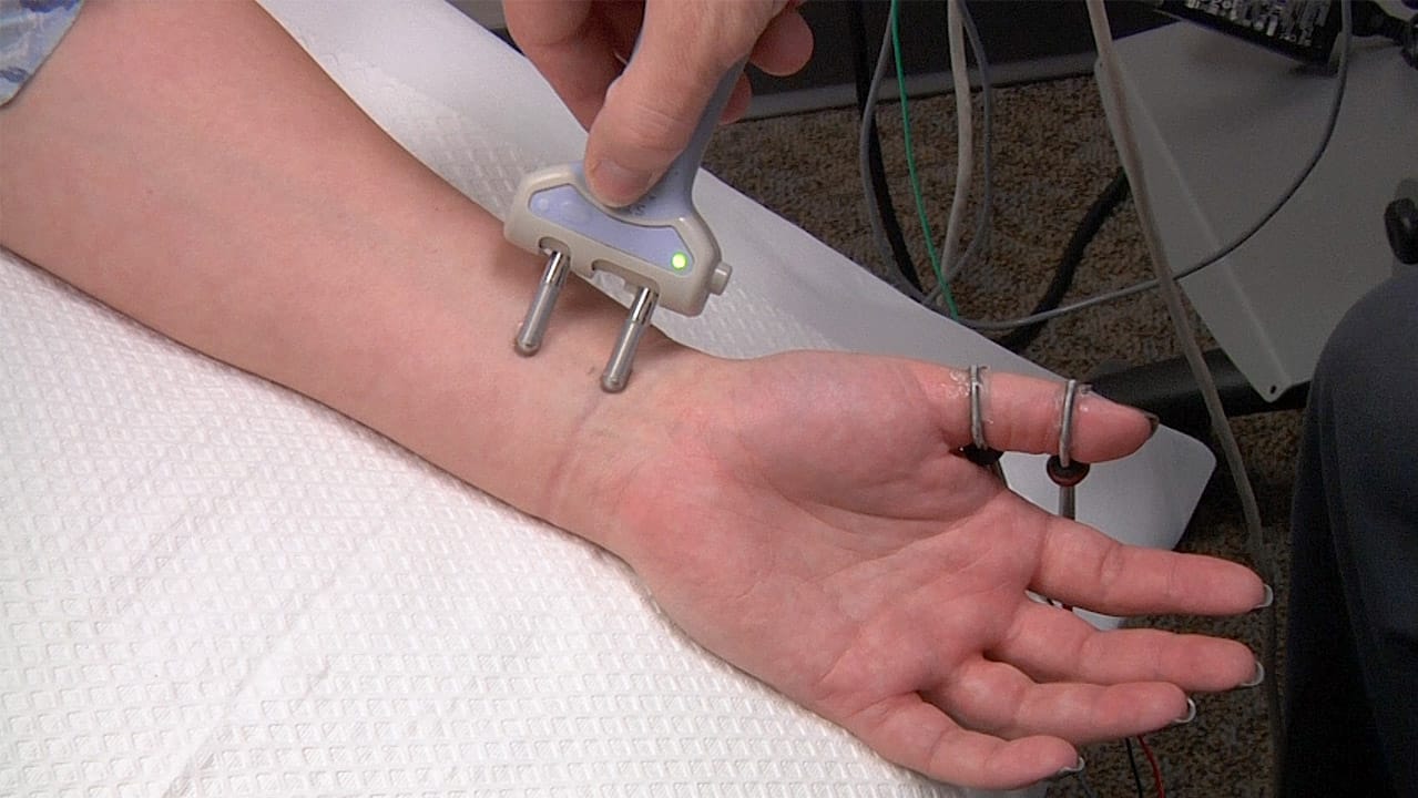 nerve conduction test