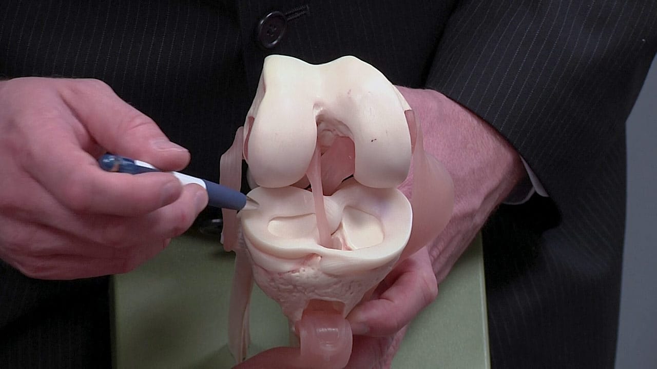 Meniscus on knee model